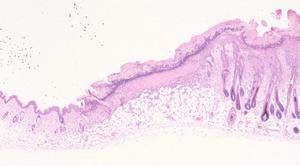 Aryl_Hydrocarbon_receptor_null_(Ahr)_Chr12